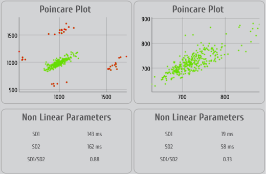 Pointcaré plot Pointcaré plot