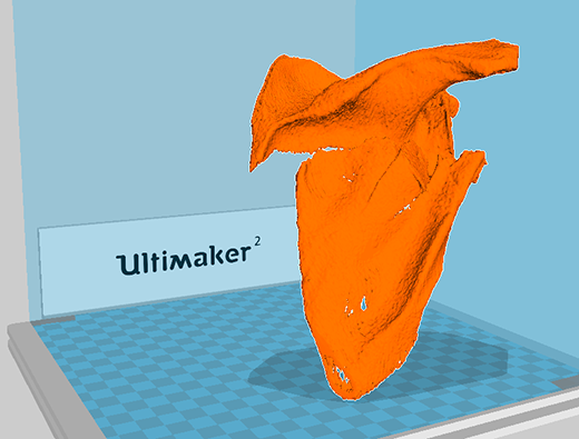 Cura screenshot of scapula Cura screenshot of scapula