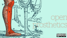 Open prosthetics